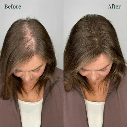 Kerarose Rosemary Shampoo For Hair Growth ( Buy 1 Get 1 Free 🔥)